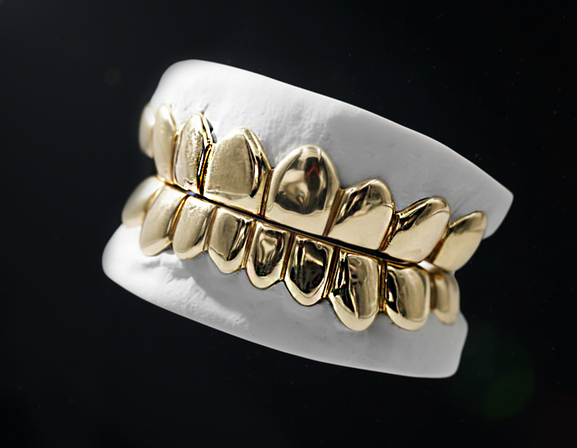 Solid Gold Grillz